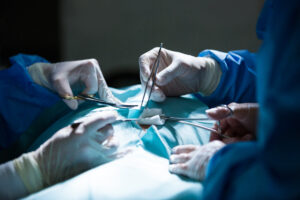 Open or laparoscopy surgery